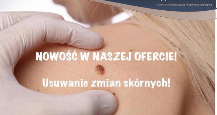 Usuwanie znamion Tomaszów Mazowiecki